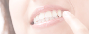 WHITENING